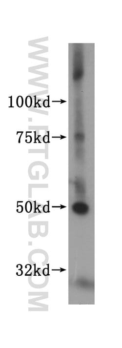 MLYCD Rabbit anti-Human, Mouse, Rat, Polyclonal, Proteintech 150 &mu;L;