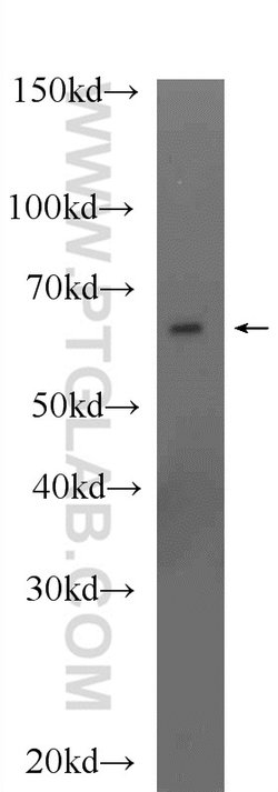 MLYCD Rabbit anti-Human, Mouse, Rat, Polyclonal, Proteintech 150 &mu;L;