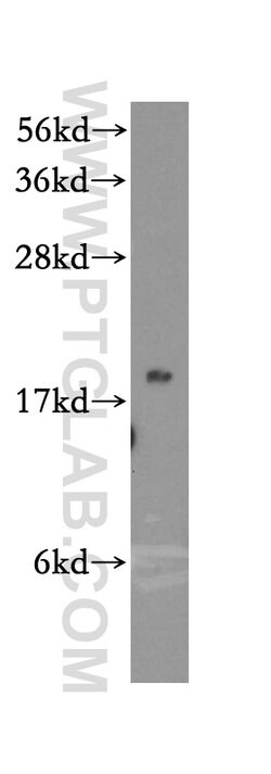 MRPS25 Rabbit anti-Human, Mouse, Rat, Polyclonal, Proteintech:Antibodies:Primary