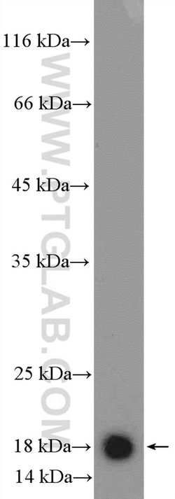 MRPS25 Rabbit anti-Human, Mouse, Rat, Polyclonal, Proteintech:Antibodies:Primary