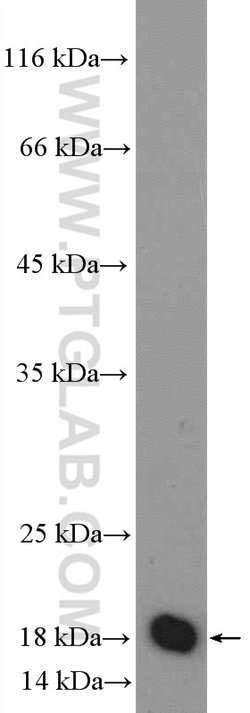 MRPS25 Rabbit anti-Human, Mouse, Rat, Polyclonal, Proteintech:Antibodies:Primary
