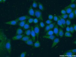 ARF5 Rabbit anti-Human, Mouse, Rat, Polyclonal, Proteintech:Antibodies:Primary