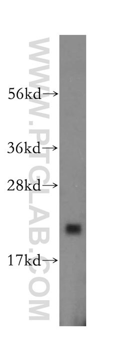 ARF5 Rabbit anti-Human, Mouse, Rat, Polyclonal, Proteintech:Antibodies:Primary