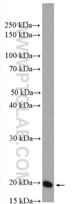 ARF5 Rabbit anti-Human, Mouse, Rat, Polyclonal, Proteintech:Antibodies:Primary