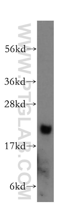 ARF5 Rabbit anti-Human, Mouse, Rat, Polyclonal, Proteintech:Antibodies:Primary