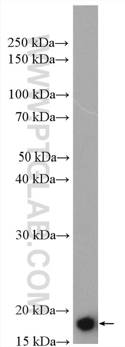 ARF5 Rabbit anti-Human, Mouse, Rat, Polyclonal, Proteintech:Antibodies:Primary