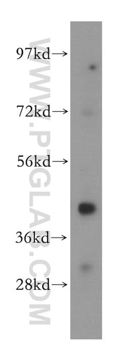 MAGEA10 Rabbit anti-Human, Polyclonal, Proteintech:Antibodies:Primary Antibodies
