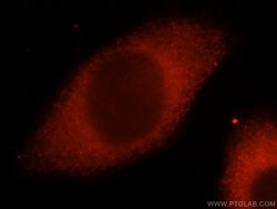 CARS Rabbit anti-Human, Polyclonal, Proteintech 150 &mu;L; Unconjugated:Antibodies,