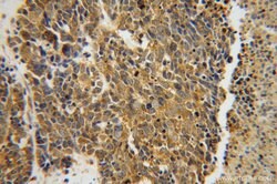 CARS Rabbit anti-Human, Polyclonal, Proteintech 150 &mu;L; Unconjugated:Antibodies,