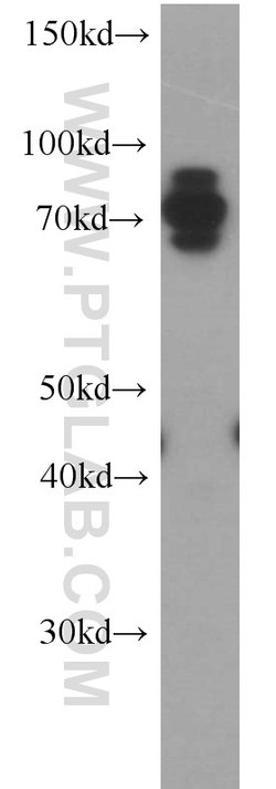 CARS Rabbit anti-Human, Polyclonal, Proteintech 150 &mu;L; Unconjugated:Antibodies,