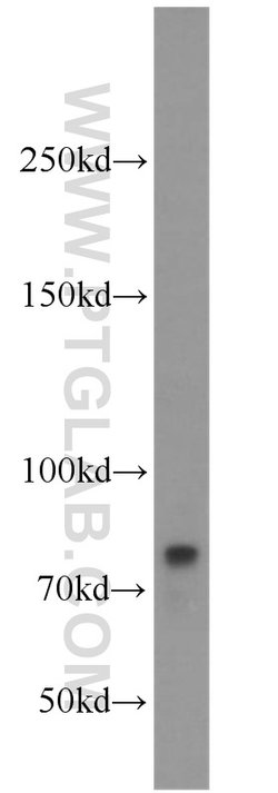 CARS Rabbit anti-Human, Polyclonal, Proteintech 150 &mu;L; Unconjugated:Antibodies,