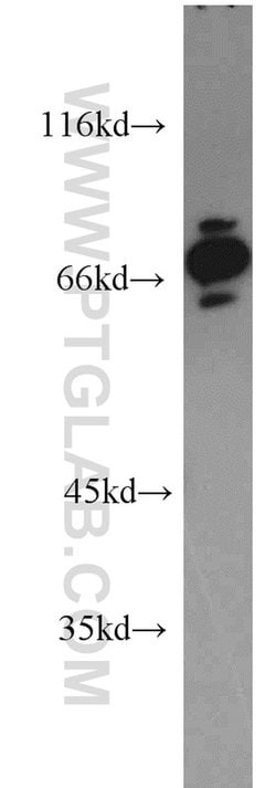 CARS Rabbit anti-Human, Polyclonal, Proteintech 150 &mu;L; Unconjugated:Antibodies,