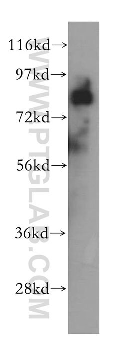 CARS Rabbit anti-Human, Polyclonal, Proteintech 150 &mu;L; Unconjugated:Antibodies,