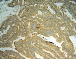 GRB14 Rabbit anti-Human, Mouse, Rat, Polyclonal, Proteintech 150 &mu;L;
