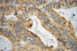 GRB14 Rabbit anti-Human, Mouse, Rat, Polyclonal, Proteintech 150 &mu;L;