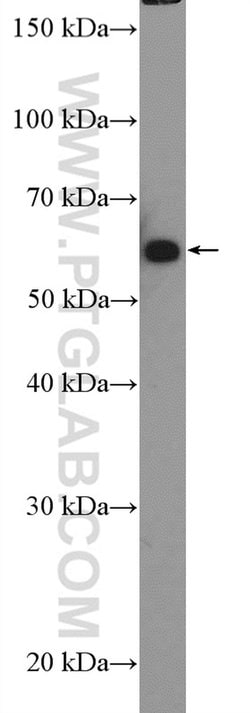 GRB14 Rabbit anti-Human, Mouse, Rat, Polyclonal, Proteintech 150 &mu;L;