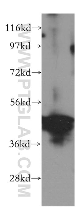 WWOX Rabbit anti-Human, Mouse, Rat, Polyclonal, Proteintech 150 &mu;L | Buy Online | Proteintech | Fisher Scientific