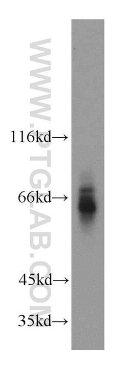ATP6AP1 Rabbit anti-Human, Mouse, Rat, Polyclonal, Proteintech:Antibodies:Primary