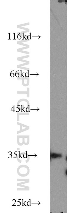 THOC6 Rabbit anti-Human, Mouse, Rat, Polyclonal, Proteintech:Antibodies:Primary