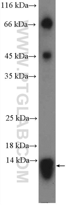 PAM16 Rabbit anti-Human, Polyclonal, Proteintech:Antibodies:Primary Antibodies