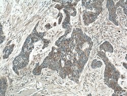 SFRP4 Rabbit anti-Human, Polyclonal, Proteintech 150 &mu;L; Unconjugated:Antibodies,