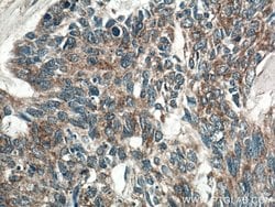 SFRP4 Rabbit anti-Human, Polyclonal, Proteintech 150 &mu;L; Unconjugated:Antibodies,