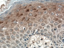 SFRP4 Rabbit anti-Human, Polyclonal, Proteintech 150 &mu;L; Unconjugated:Antibodies,