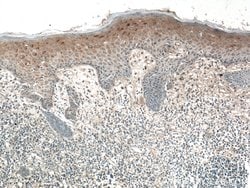SFRP4 Rabbit anti-Human, Polyclonal, Proteintech 150 &mu;L; Unconjugated:Antibodies,