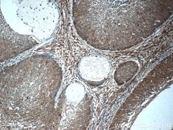 SFRP4 Rabbit anti-Human, Polyclonal, Proteintech 150 &mu;L; Unconjugated:Antibodies,