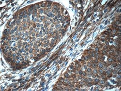 SFRP4 Rabbit anti-Human, Polyclonal, Proteintech 150 &mu;L; Unconjugated:Antibodies,