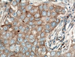 SFRP4 Rabbit anti-Human, Polyclonal, Proteintech 150 &mu;L; Unconjugated:Antibodies,