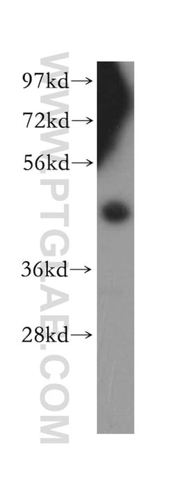 SFRP4 Rabbit anti-Human, Polyclonal, Proteintech 150 &mu;L; Unconjugated:Antibodies,