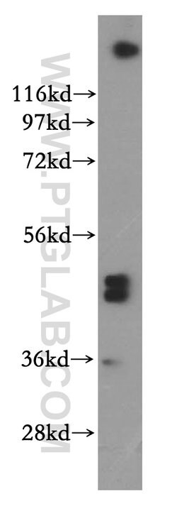 SFRP4 Rabbit anti-Human, Polyclonal, Proteintech 150 &mu;L; Unconjugated:Antibodies,