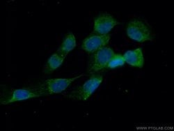 MVD Rabbit anti-Human, Mouse, Rat, Polyclonal, Proteintech 150 &mu;L; Unconjugated:Antibodies,