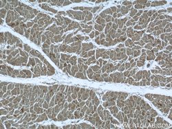 MVD Rabbit anti-Human, Mouse, Rat, Polyclonal, Proteintech 150 &mu;L; Unconjugated:Antibodies,