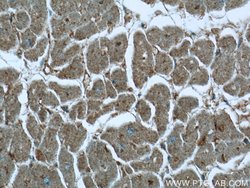 MVD Rabbit anti-Human, Mouse, Rat, Polyclonal, Proteintech 150 &mu;L; Unconjugated:Antibodies,