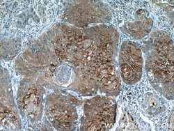 MVD Rabbit anti-Human, Mouse, Rat, Polyclonal, Proteintech 150 &mu;L; Unconjugated:Antibodies,