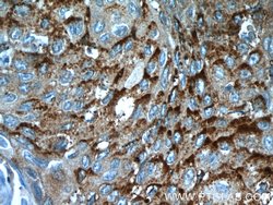 MVD Rabbit anti-Human, Mouse, Rat, Polyclonal, Proteintech 150 &mu;L; Unconjugated:Antibodies,