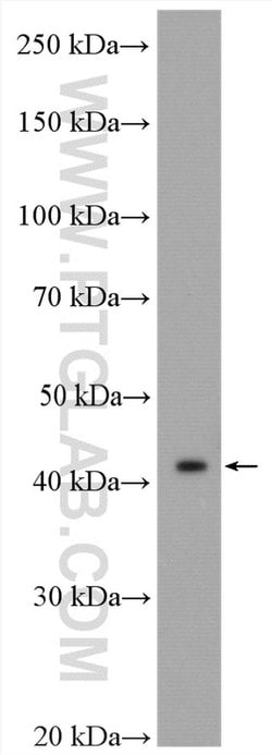 MVD Rabbit anti-Human, Mouse, Rat, Polyclonal, Proteintech 150 &mu;L; Unconjugated:Antibodies,