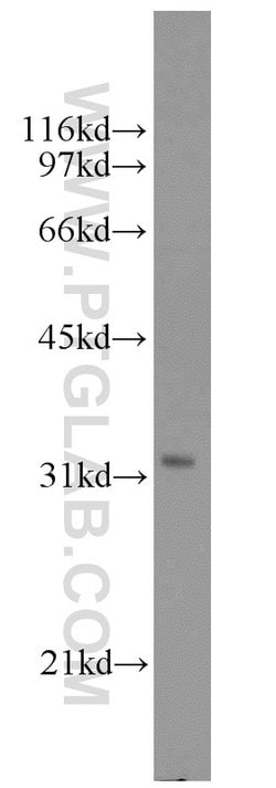 MED6 Rabbit anti-Human, Mouse, Rat, Polyclonal, Proteintech 20 &mu;L | Buy Online | Proteintech | Fisher Scientific