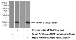 TRIAP1 Rabbit anti-Human, Mouse, Rat, Polyclonal, Proteintech 150 &mu;L;