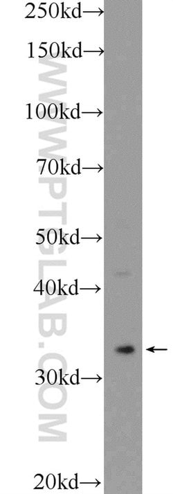 Cyclophilin E Rabbit anti-Human, Mouse, Rat, Polyclonal, Proteintech:Antibodies:Primary
