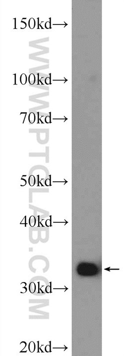 Cyclophilin E Rabbit anti-Human, Mouse, Rat, Polyclonal, Proteintech:Antibodies:Primary
