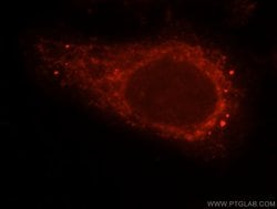 beta Arrestin 1 Rabbit anti-Human, Mouse, Polyclonal, Proteintech:Antibodies:Primary