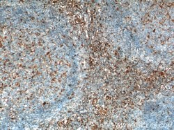 beta Arrestin 1 Rabbit anti-Human, Mouse, Polyclonal, Proteintech:Antibodies:Primary