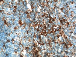 beta Arrestin 1 Rabbit anti-Human, Mouse, Polyclonal, Proteintech:Antibodies:Primary