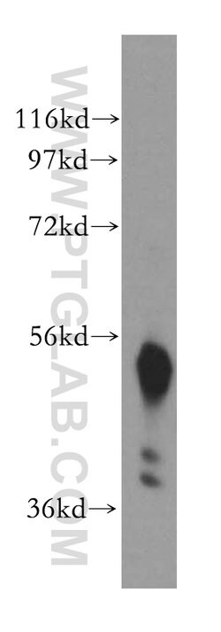 beta Arrestin 1 Rabbit anti-Human, Mouse, Polyclonal, Proteintech:Antibodies:Primary