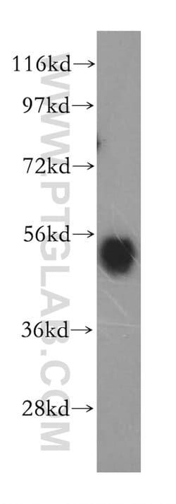 beta Arrestin 1 Rabbit anti-Human, Mouse, Polyclonal, Proteintech:Antibodies:Primary