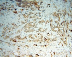 CES2 Rabbit anti-Human, Polyclonal, Proteintech:Antibodies:Primary Antibodies