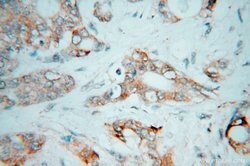 CES2 Rabbit anti-Human, Polyclonal, Proteintech:Antibodies:Primary Antibodies